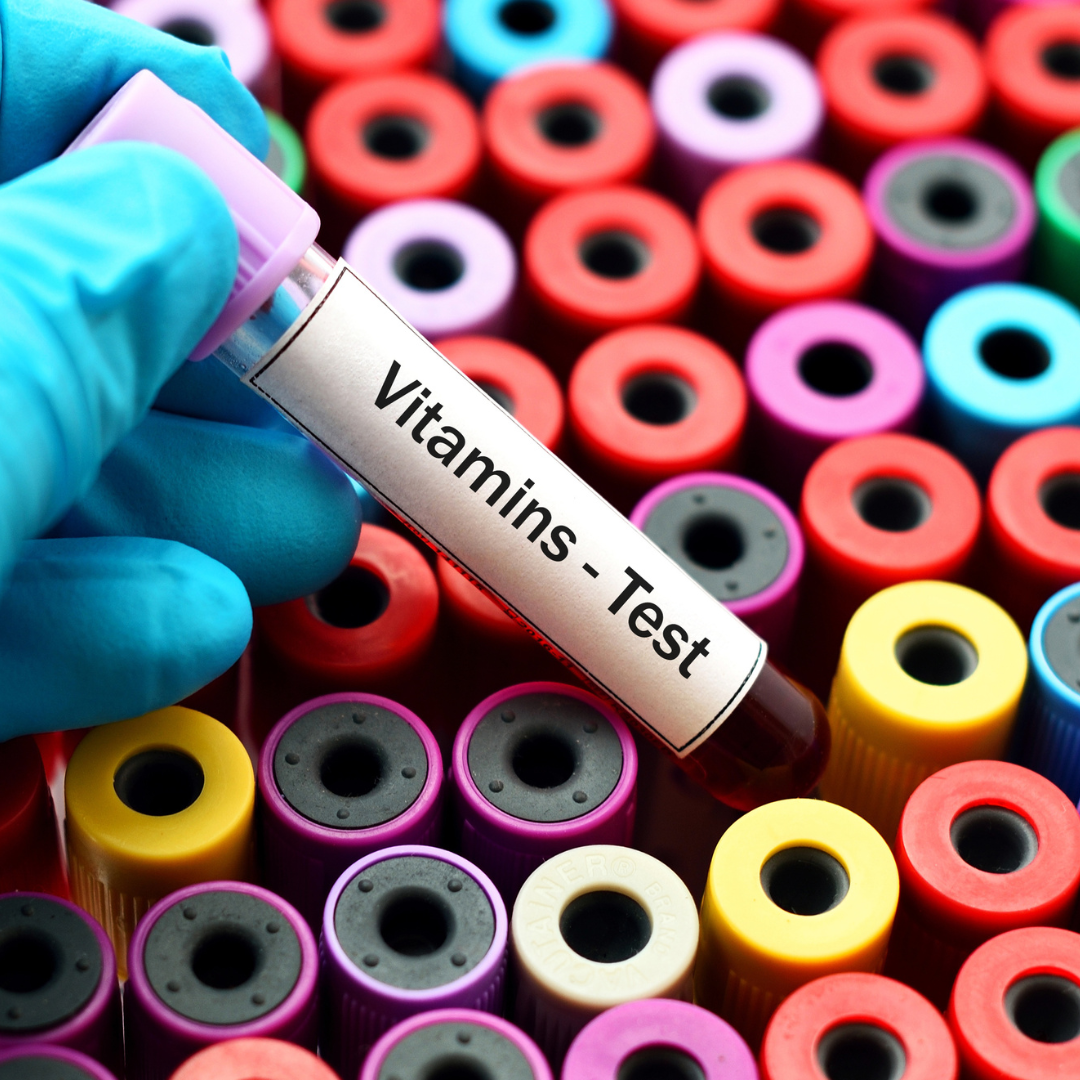 Vitamin Profile Test Dubai Lab Tests