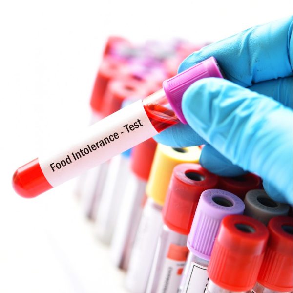 Discover Your Food Intolerances with Dubai Lab Tests Today