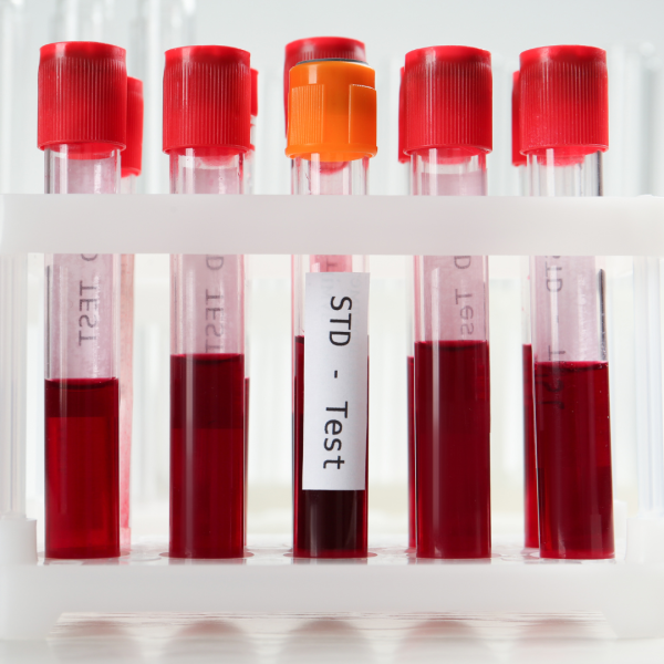 Sexual Transmitted Infection with HIV Test