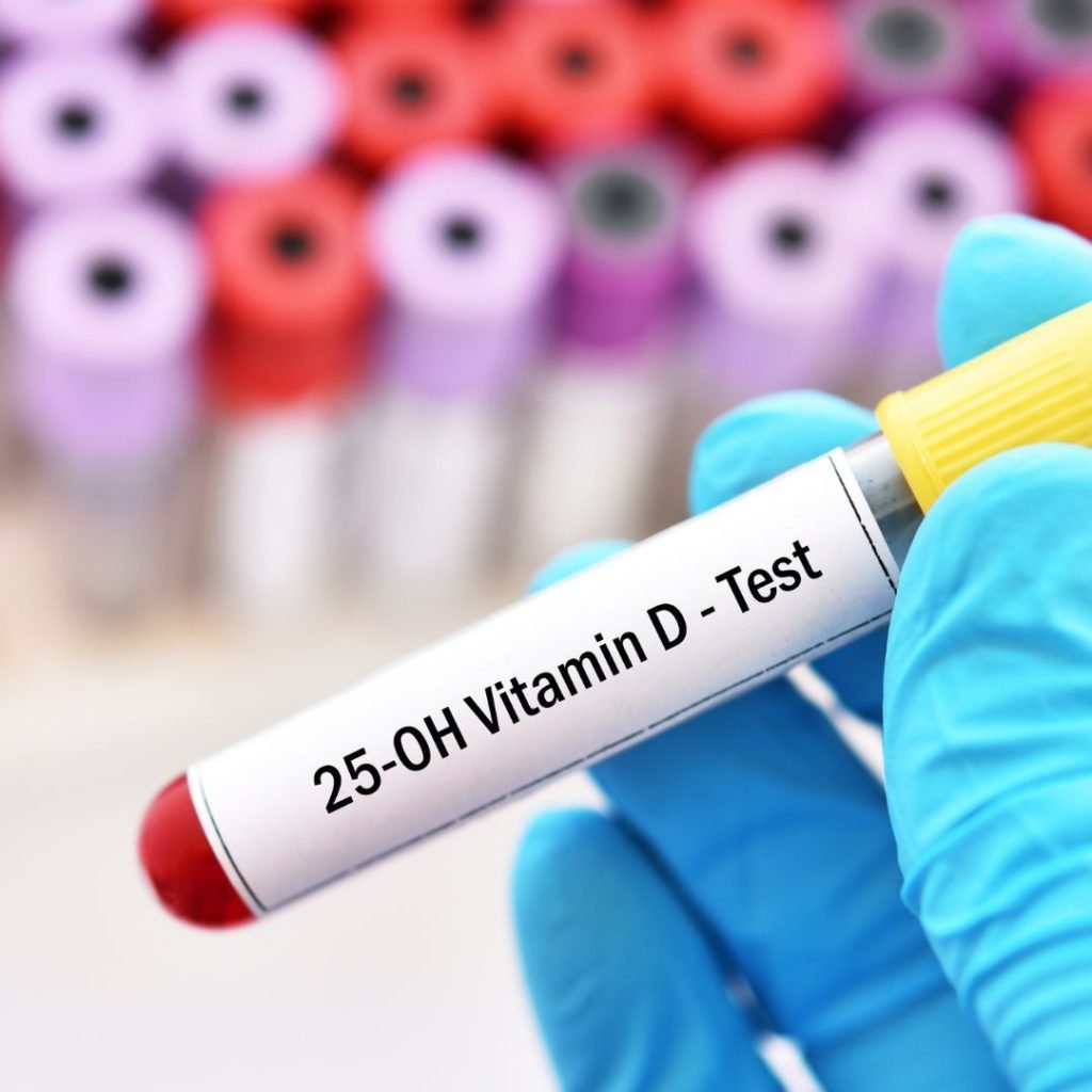 25OH Vitamin D Test Dubai Lab Tests