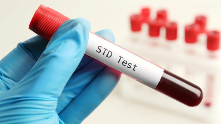 Understanding STD Tests: Essential Information and Screening Options