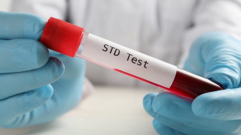 The Top 10 Frequently Asked Questions About STD Testing