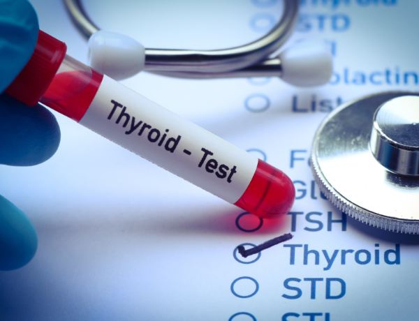 Thyroid Profile Tests