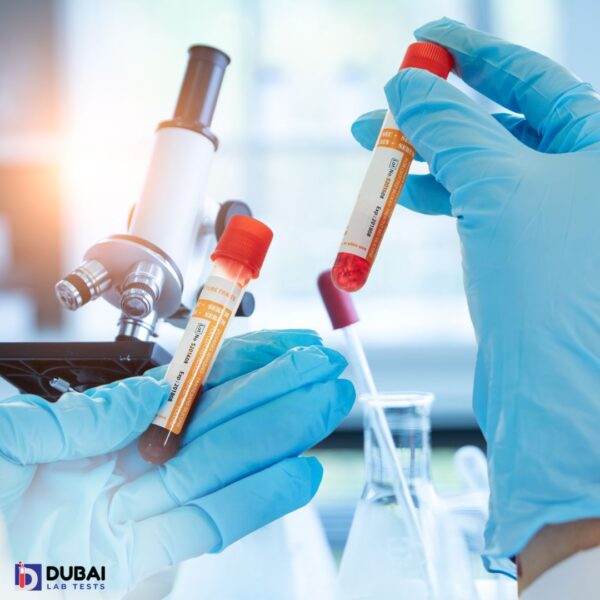 High-Purity Albumin Protein for Serum Analysis | Spectrophotometry Method | 1-Day TAT | Essential for Health, Recovery & Research