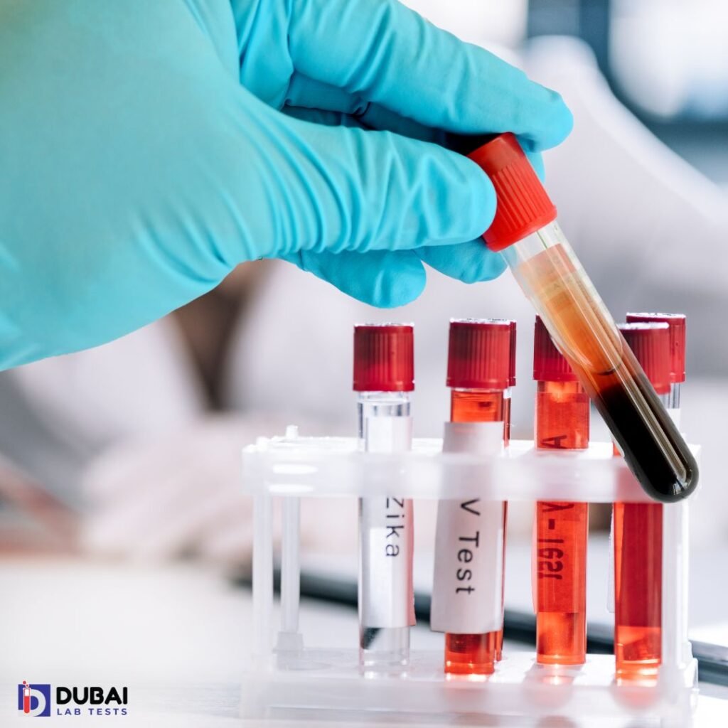 about dubai lab tests, dubai lab test immunology large