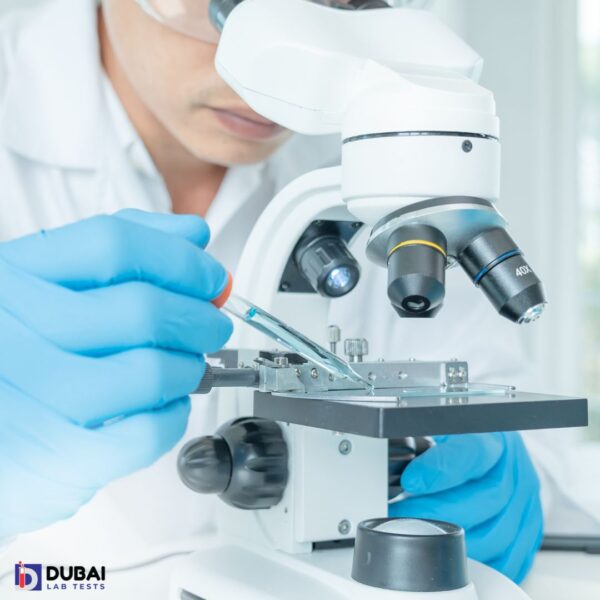 STD PCR single -Treponema Pallidium