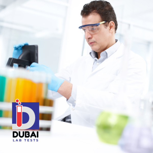 Anti-Rubella IgG Antibody Test
