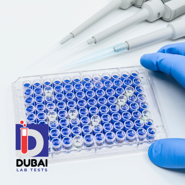 Aspergillus IgM Antibody Test