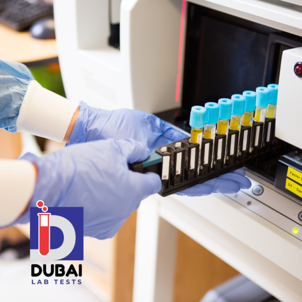 C13 Urea Breath Test