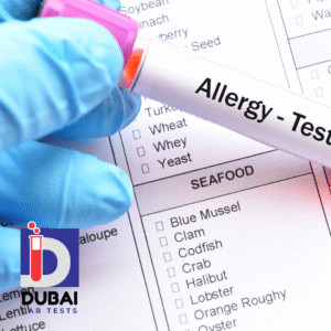 Chocolate Allergen