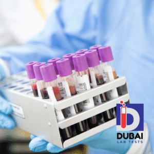 Clostridium difficile Toxin B Rapid Test