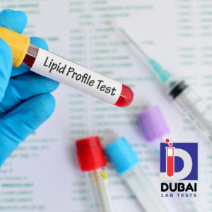 Comprehensive Lipid Profile II Test