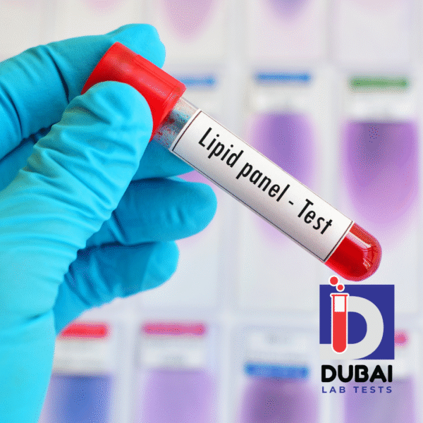 Comprehensive Lipid Profile II Test