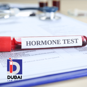 DHEA Blood Test