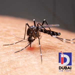 Dengue IgG Antibody