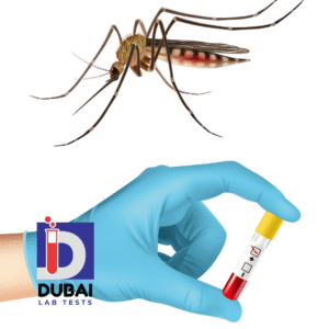 Dengue IgM Antibody