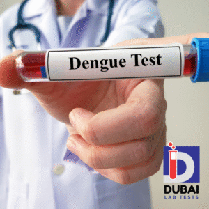 Dengue IgM Antibody