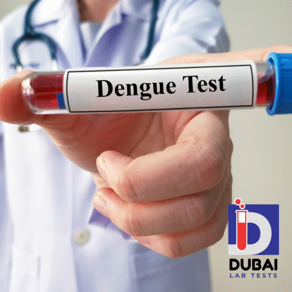 Dengue IgM Antibody