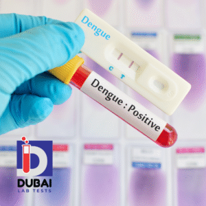 Dengue NS1 Antigen Test