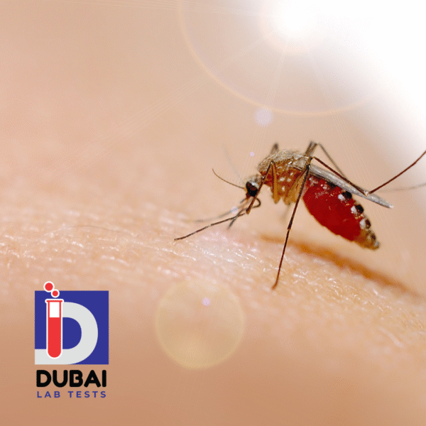 Dengue NS1 Antigen Test