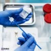 Tzanck Smear Vesicle Fluid