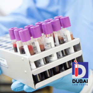 Erythropoietin Lab Test