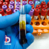 Folate Serum Test