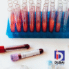 Gabapentin Serum Test
