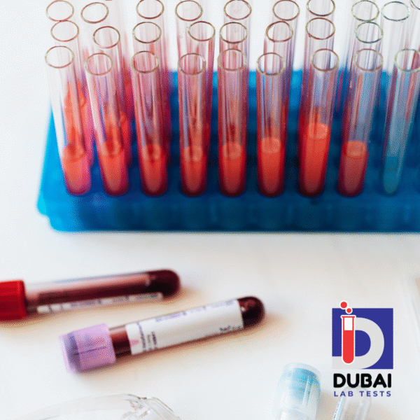 Gabapentin Serum Test