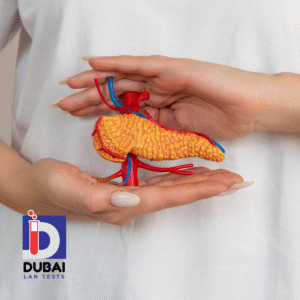 Glucagon Lab Test
