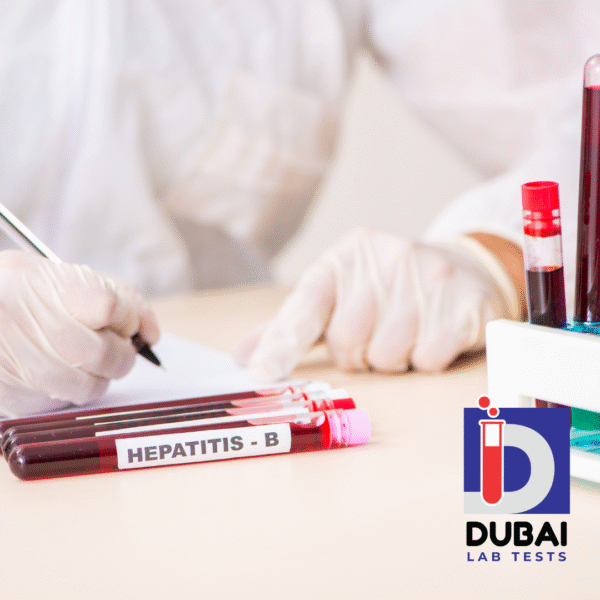 Hepatitis B