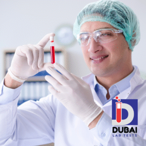 Hepatitis B Virus PCR Test
