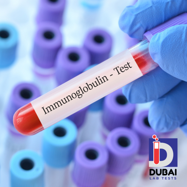 Immunoglobulin E (IgE) test