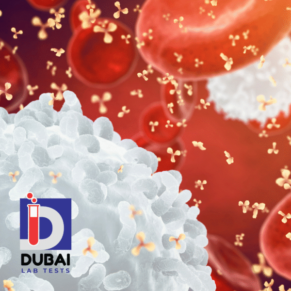 Immunoturbidometry Test