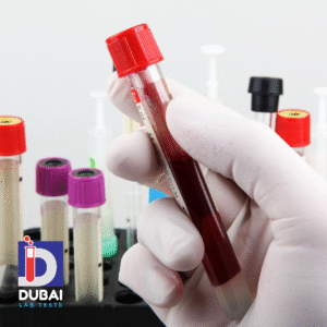 Prolactin Blood Test