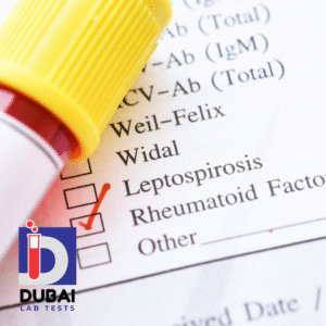 Rheumatoid Factor