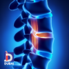 SPINAL MUSCULAR ATROPHY (SMA) Test – Fast & Accurate Genetic Screening
