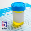 The Uric Acid 24-Hour Urine Test