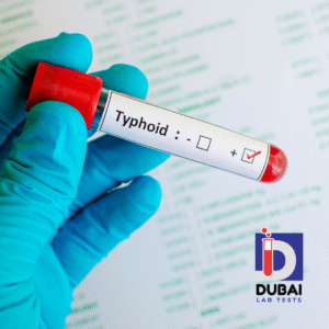 Widal Test
