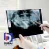 CBCT