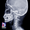 Cephalometric X-Ray