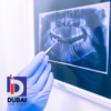 Cephalometric X-Ray & OPG