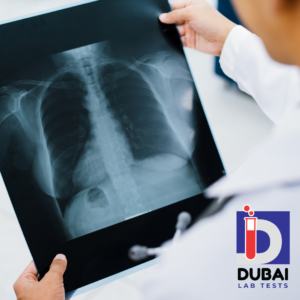 X-Ray Single View Imaging